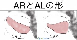 アメリカ 英語 発音のコツ! RとLのの発音を使い分ける